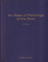 cover of the book An Atlas of Pathology of the Brain