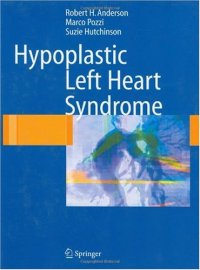 cover of the book Hypoplastic Left Heart Syndrome