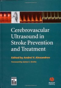 cover of the book Cerebrovascular Ultrasound in Stroke Prevention and Treatment