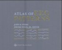 cover of the book An Atlas of EEG Patterns