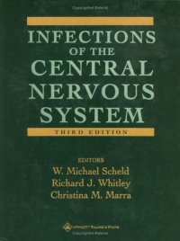 cover of the book Infections of the Central Nervous System