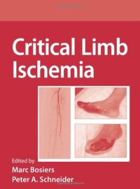 cover of the book Critical Limb Ischemia