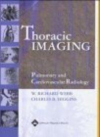 cover of the book Thoracic Imaging: Pulmonary and Cardiovascular Radiology