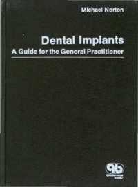 cover of the book Dental Implants: A Guide for the General Practitioner