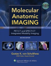 cover of the book Molecular Anatomic Imaging: PET-CT and SPECT-CT Integrated Modality Imaging, 2nd Edition