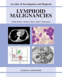 cover of the book Lymphoid Malignancies: An Atlas of Investigation and Management