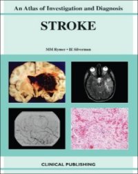 cover of the book Ischemic Stroke: An Atlas of Investigation and Treatment (Atlases of Investigation and Management)