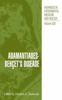 cover of the book Adamantiades-Behçet’s Disease