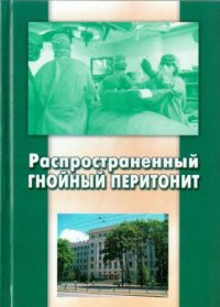 cover of the book Распространенный гнойный перитонит