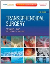 cover of the book Transsphenoidal Surgery: Expert Consult - Online and Print  