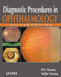 cover of the book Diagnostic Procedures in Ophthalmology 2nd Edition  