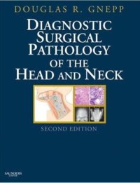 cover of the book Diagnostic Surgical Pathology of the Head and Neck: Expert Consult - Online and Print (Expert Consult Title: Online + Print)  