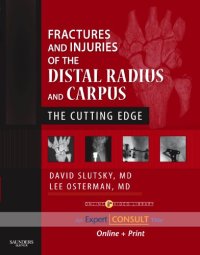 cover of the book Fractures and Injuries of the Distal Radius and Carpus: The Cutting Edge - Expert Consult: Online and Print (Expert Consult Title: Online + Print)  