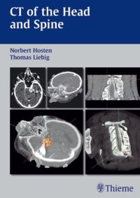 cover of the book CT of the Head and Spine  