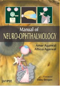 cover of the book Manual of Neuro Ophthalmogy  