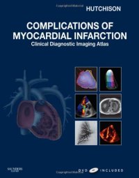 cover of the book Complications of Myocardial Infarction: Clinical Diagnostic Imaging Atlas with DVD (Cardiovascular Emergencies: Atlas and Multimedia)  