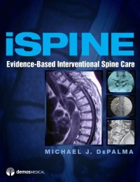 cover of the book iSpine: Evidence-Based Interventional Spine Care  