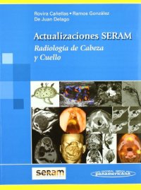 cover of the book Actualizaciones SERAM: Radiologia De Cabeza Y Cuello  