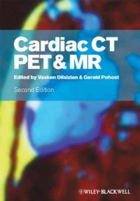 cover of the book Cardiac CT, PET and MR, Second Edition  