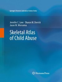 cover of the book Skeletal Atlas of Child Abuse 