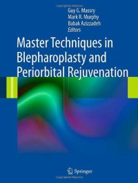 cover of the book Master Techniques in Blepharoplasty and Periorbital Rejuvenation    