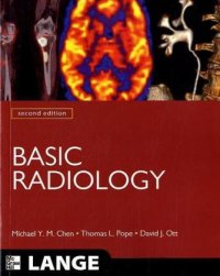 cover of the book Basic Radiology, 2nd Edition 