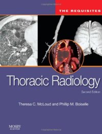 cover of the book Thoracic Radiology: The Requisites, Second Edition