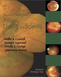 cover of the book Atlas of Uvetis and Scleritis