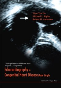 cover of the book Echocardiography in Congenital Heart Disease Made Simple (Cardiopulmonary Medicine from Imperial College Press)