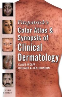 cover of the book Fitzpatrick Color Atlas and Synopsis of Clinical Dermatology (Fitzpatrick's Color Atlas & Synopsis of Clinical Dermatology)