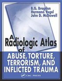 cover of the book A radiologic atlas of abuse, torture, terrorism, and inflicted trauma