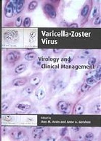 cover of the book Varicella-zoster virus : virology and clinical management