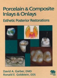 cover of the book Porcelain & Composite Inlays & Onlays: Esthetic Posterior Restorations