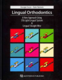 cover of the book Lingual Orthodontics: A New Approach Using STb Light Lingual System and Lingual Straight Wire