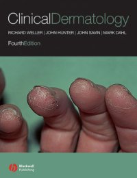 cover of the book Clinical Dermatology, Fourth Edition